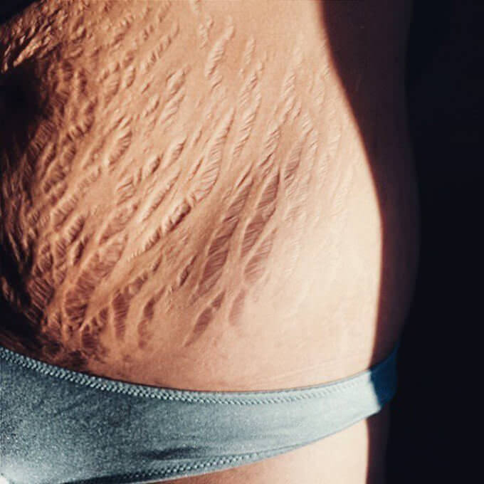 Крупная грудь раздетой беременной брюнетки   15 фото эротики