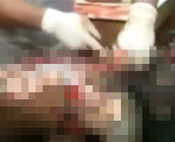 レイプされてから殺され燃やされた少女の遺体を検死解剖する映像…