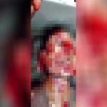 【閲覧注意】顔面を破壊され殺された人間の死体がエグすぎる…