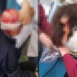 中国人女さん、機械に髪が巻き込まれる→頭皮ごと髪を持っていかれる