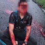 オートバイで事故った男、命は無事でも顔面は終わる