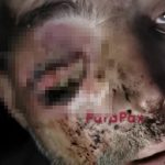 【閲覧注意】ロシア兵の腐った目はウジ虫だらけになる…