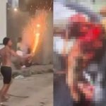 片手に花火を持ってはしゃぐ酔っ払い、花火が爆発して手がぐちゃぐちゃに