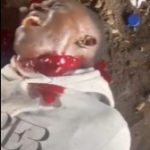 時間が経てば死にます…首に穴を開けられたアフリカ人、血が噴き出す