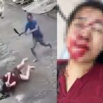 突然の狂気…鎌を持った男、ダッシュで近付いて女の顔面を切り裂く