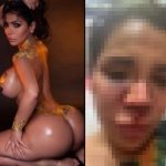 レイプ被害に遭ったインフルエンサー、顔面をボコボコにされる…