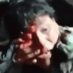 生きているだけまし、男同士でマチェーテを持っての戦いで血だらけに