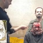 これはどういった罰？ただひたすらに額を痛めつけられる男