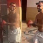 はしゃぎすぎたサッカーファン、花火の爆発で右手が逝く