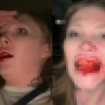 ライブ配信をしていた女さん、ファンから襲撃されて口から出血
