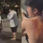 中国で集団闘争中、男が刺されて血が流れた…