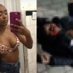 自撮りの写真とは違う姿に…バイク事故に遭った女、変わり果てた姿に…