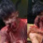 銃器で遊んでいた男、誤って自分を撃ってしまい顔面崩壊