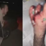 さようなら指…車の中で花火をしようとした男、爆発して指が吹き飛ぶ
