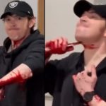 精神異常者のイカれた行動、自分のナイフで自分自身の腕と首を斬る男