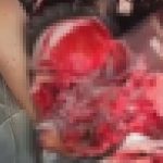 事故に遭って苦しむ女の近くには…頭が吹き飛んだ男の死体が… 事故に遭って苦しむ女の近くには…頭が吹き飛んだ男の死体が…