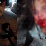 ロシアの10代のメスガキたち、27歳の女を暴行し顔面血だらけにする ロシアの10代のメスガキたち、27歳の女を暴行し顔面血だらけにする