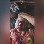 命があっても今後のこと考えると…派手に事故って逝く人たち 命があっても今後のこと考えると…派手に事故って逝く人たち