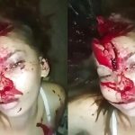 人生の最期が悲惨すぎる…血を流し痛い思いをしながら逝く人たち