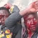 電話泥棒の末路が悲惨すぎる…ワイヤーで殴られ頭にレンガを当てられ気絶 電話泥棒の末路が悲惨すぎる…ワイヤーで殴られ頭にレンガを当てられ気絶