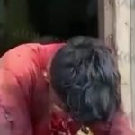 どっちにしても人生終わった…自分の顔面を撃って生き残った男